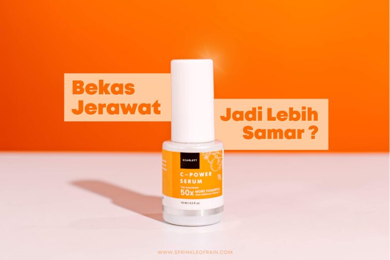 Seri Serum Lokal: Menghilangkan Bekas Jerawat dengan Lebih Mudah!