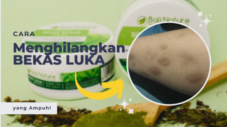 Temukan Kepercayaan Diri Anda dengan Salep Penghilang Bekas Luka!