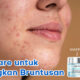 Tips Skincare Ampuh untuk Mengatasi Bruntusan di Pipi!